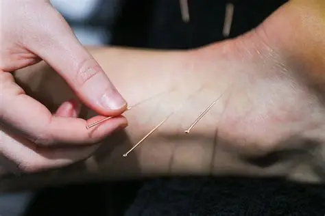 Acupuncture Therapy in Mira Road Thane